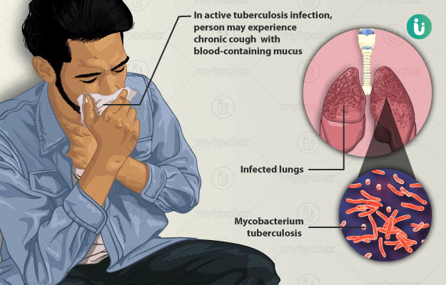 टीबी रोग क्या है? टीबी से बचाव ही टीबी का इलाज है